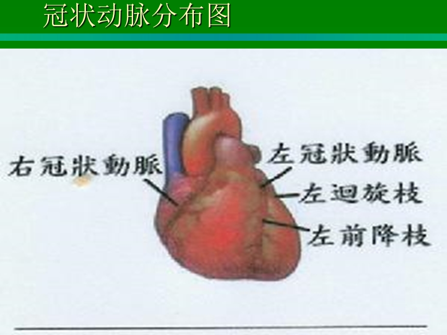 心肌梗死的护理.ppt_第3页