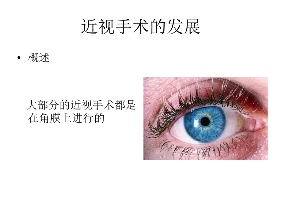 近视手术发展史.ppt_第1页