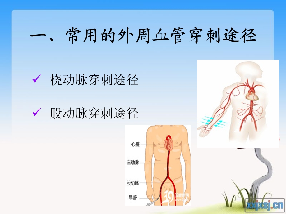 冠脉介入术后护理要点　.ppt_第2页