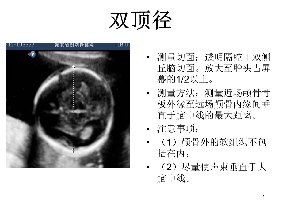 产科超声标准切面25张图.ppt_第1页