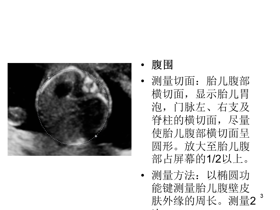 产科超声标准切面25张图.ppt_第3页