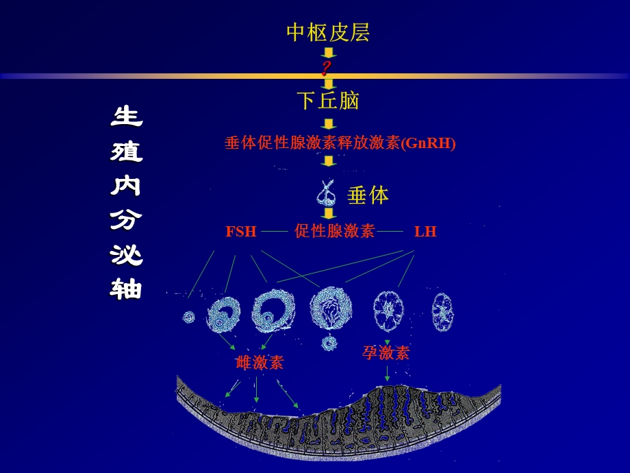 多囊卵巢综合征的病因、诊断及治疗.ppt_第2页