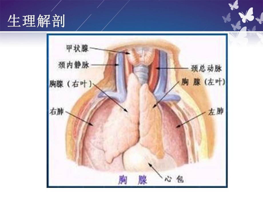 胸腺瘤围手术期护理临床医学医药卫生专业资料.ppt_第3页