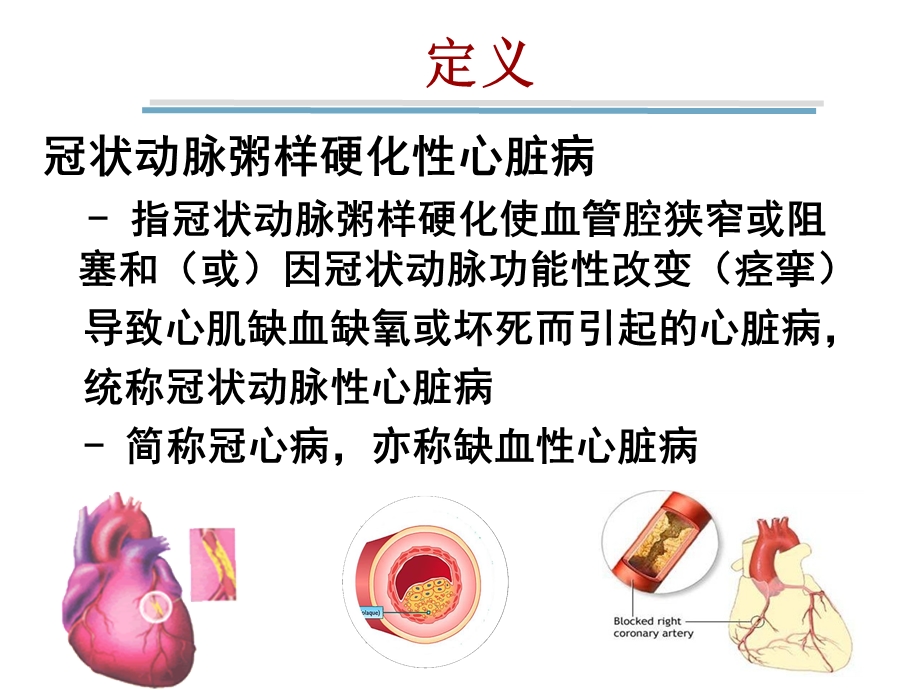 冠心病.ppt(修改).ppt_第2页