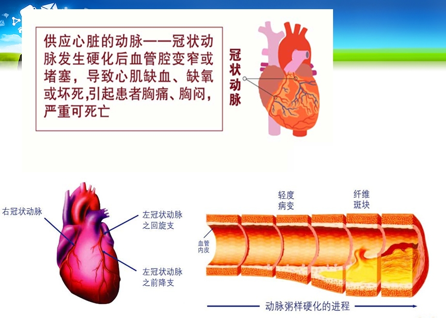 冠心病的康复主要内容PPT.ppt_第3页