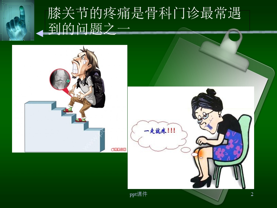 膝关节疼痛的诊断与治疗-课件.ppt_第2页