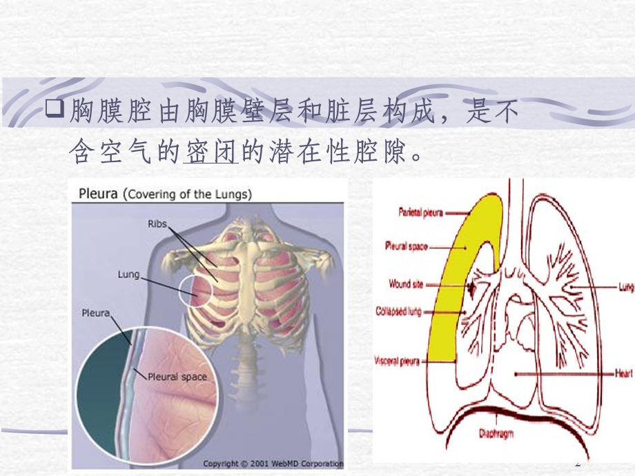 自发性气胸的课件.ppt_第2页