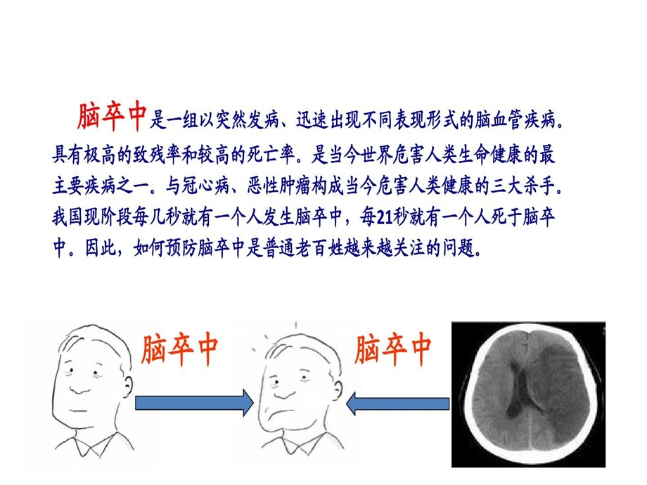 脑卒中趣味版课件.ppt_第2页