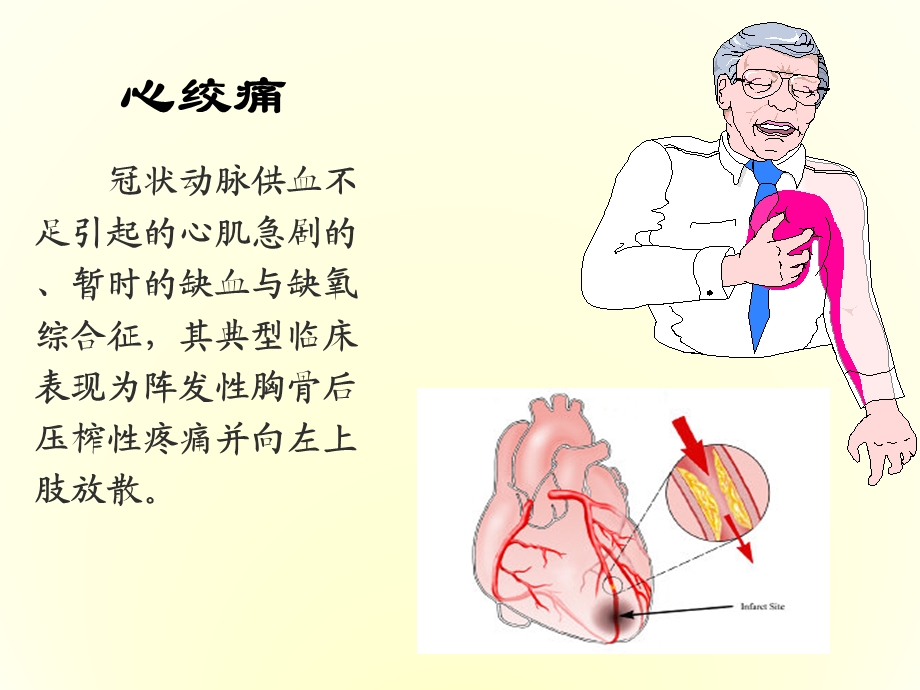 第二十四章抗心绞痛药课件.ppt_第3页