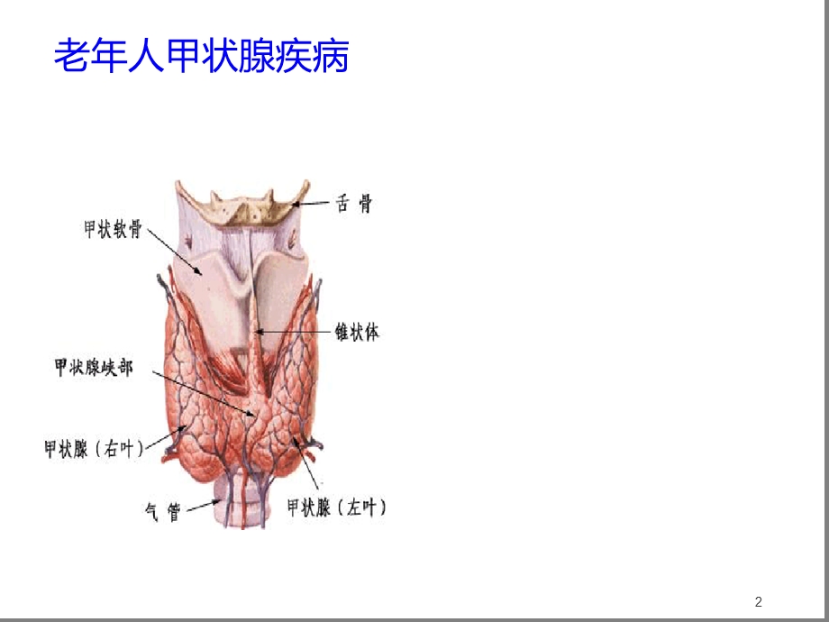 老年人甲状腺疾病参考幻灯片课件.ppt_第2页