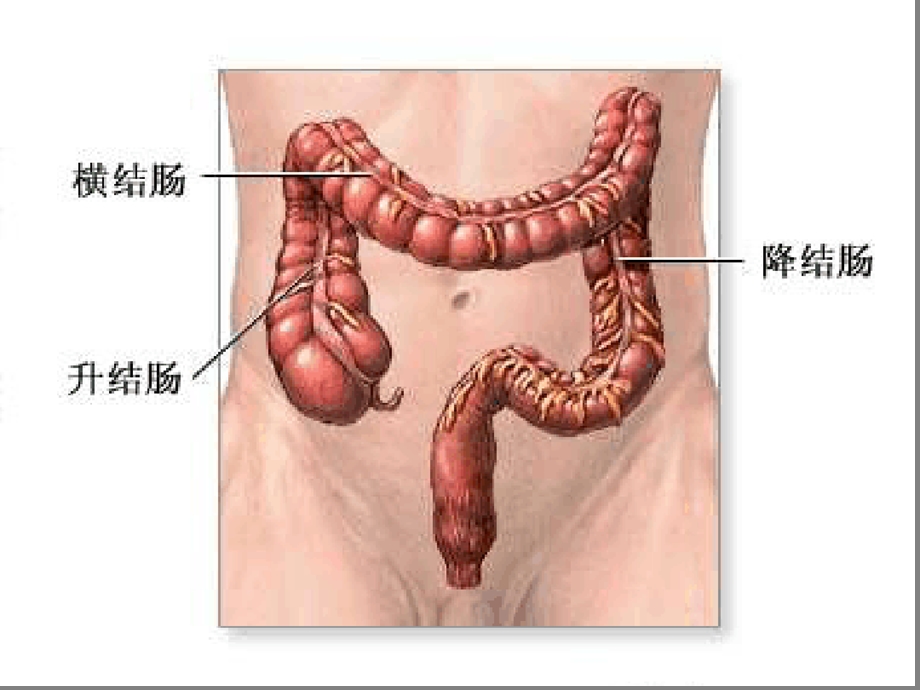 结肠癌外科学课件.ppt_第2页