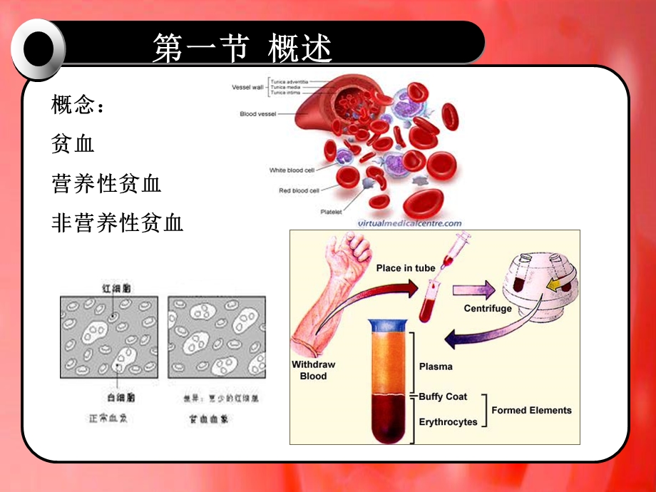 第二十三章-改善营养性贫血的功能性食品-课件.ppt_第3页