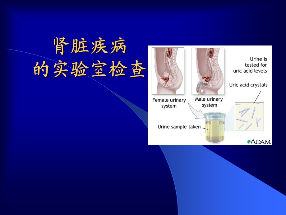 肾脏疾病的实验室检查-课件.ppt_第1页