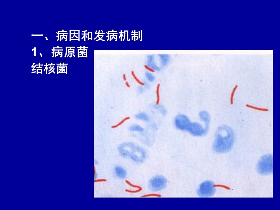 第六节-肺结核-课件.ppt_第2页