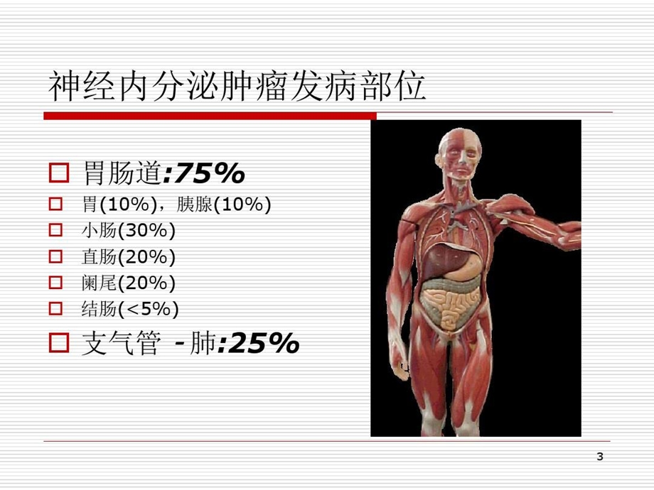 胃肠胰神经内分泌肿瘤的诊断与治疗课件.ppt_第3页