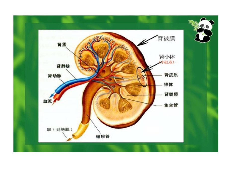 肾源性水肿护理课件.ppt_第3页