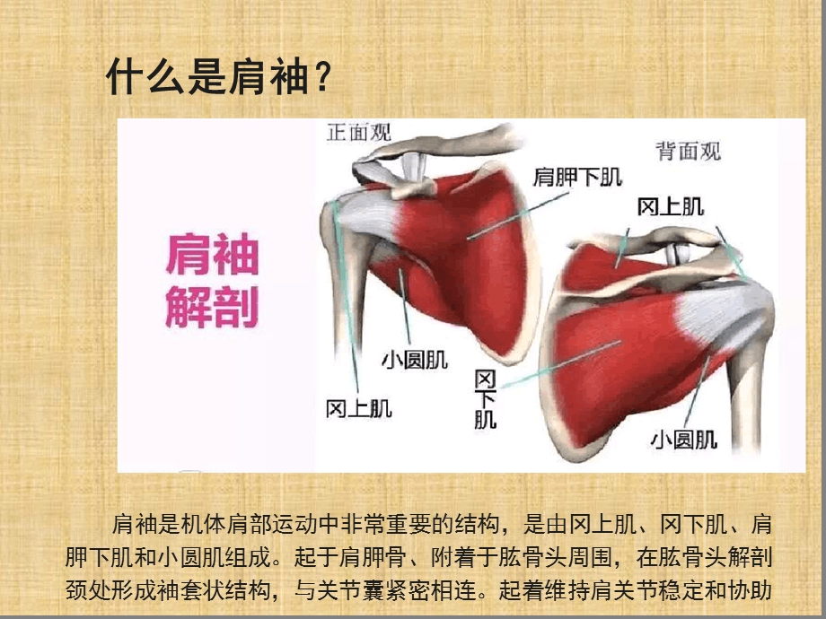 肩袖损伤护理疾病查房课件.ppt_第3页