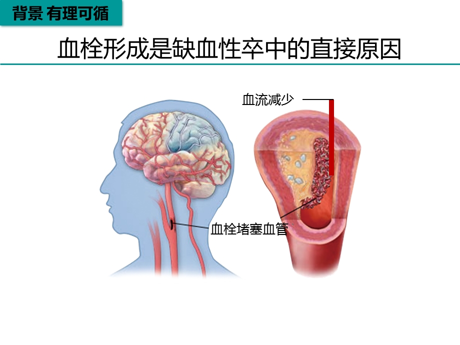 脑梗死再灌注治疗-课件.ppt_第3页