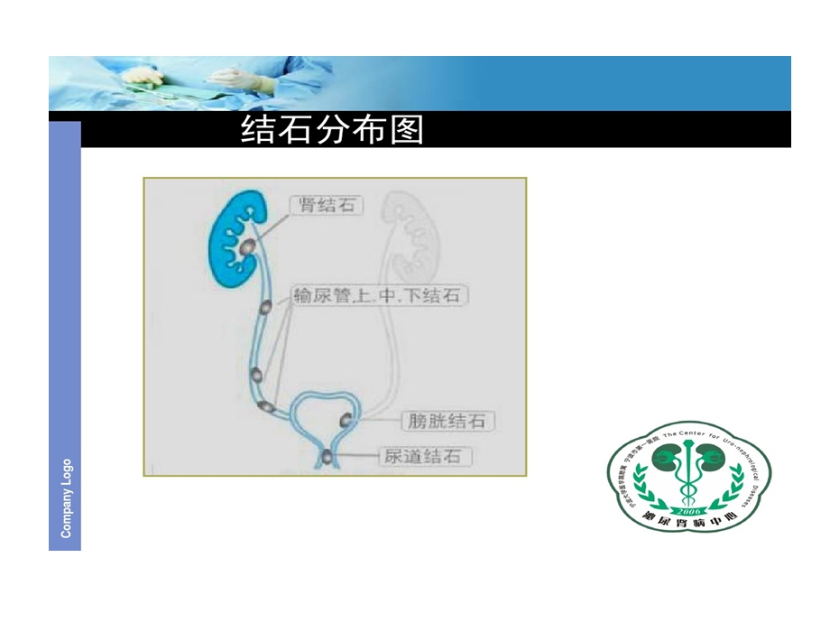 输尿管软镜及硬镜碎石护理课件.ppt_第3页