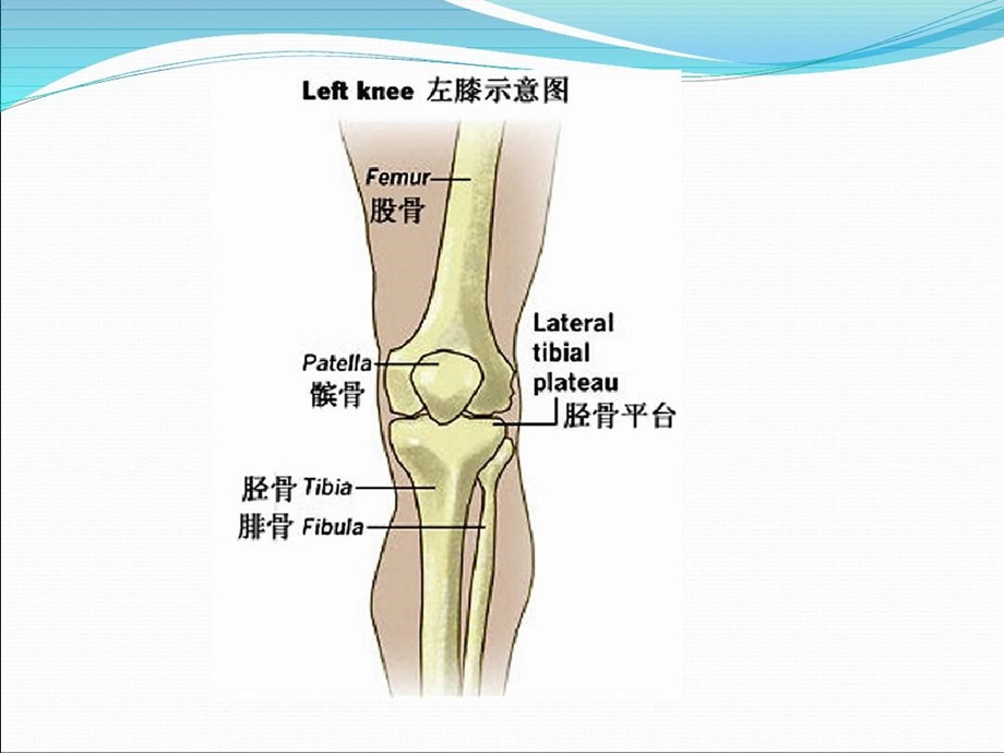 胫骨平台骨折的护理课件.ppt_第3页