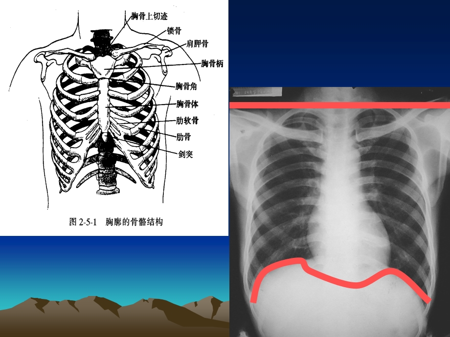 胸部及肺与胸膜检查课件.ppt_第2页