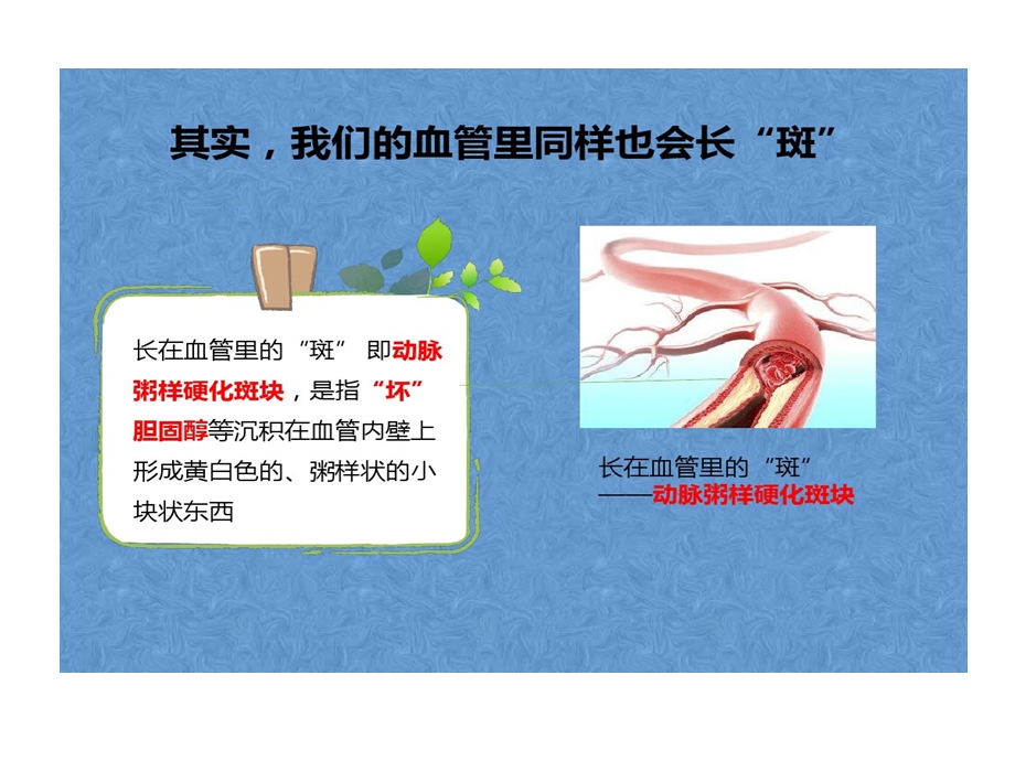 血管斑块风险课件.ppt_第3页