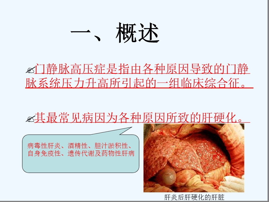 肝硬化门静脉高压食管胃静脉曲张出血防治共识课件.ppt_第2页