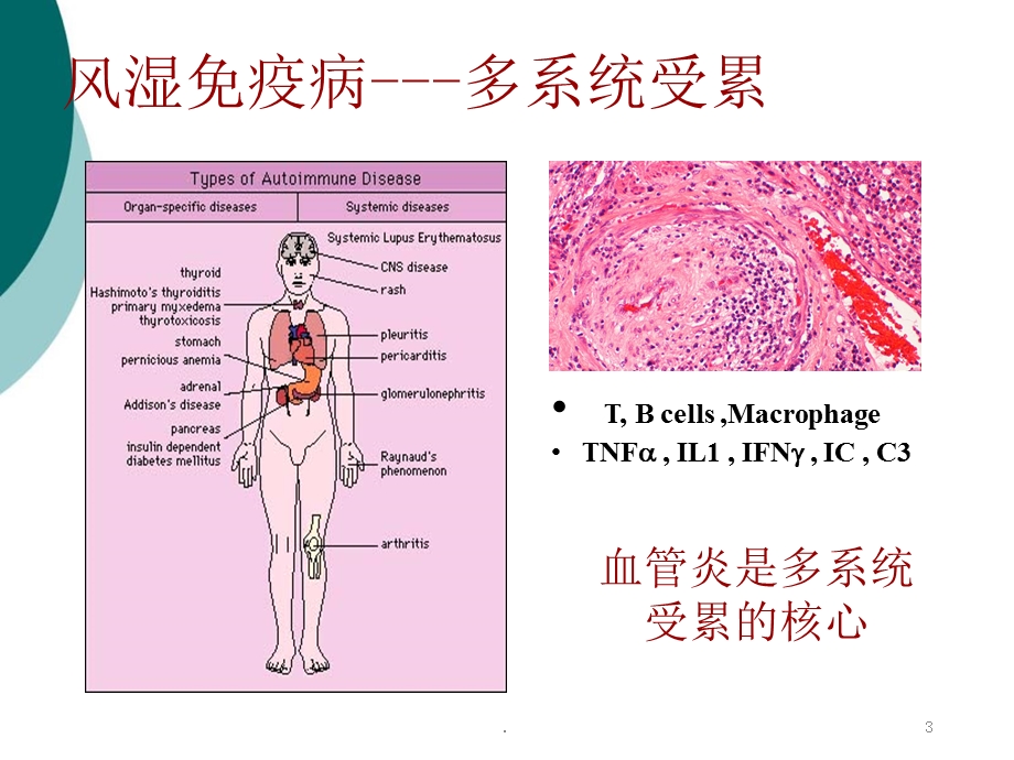 自身免疫性疾病的消化系统损害课件.ppt_第3页