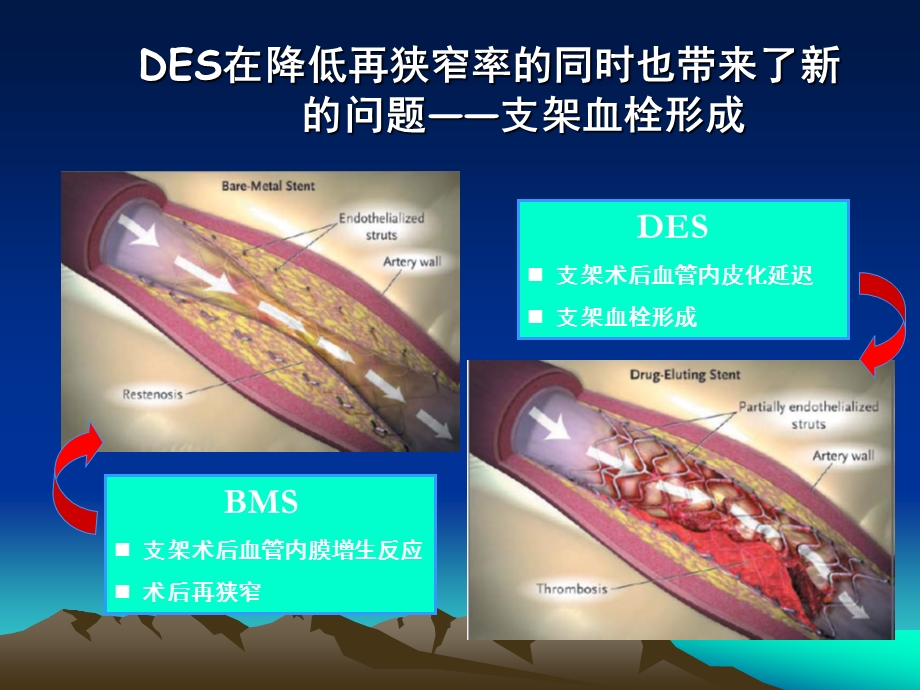 长期双重抗血小板治疗课件.ppt_第3页