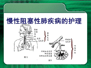 第九章老年人呼吸系统常见疾病护理课件.ppt