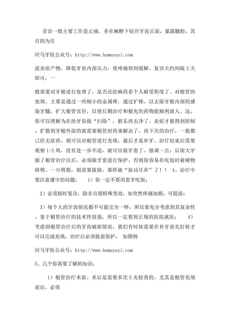 什么是根管治疗.docx_第2页