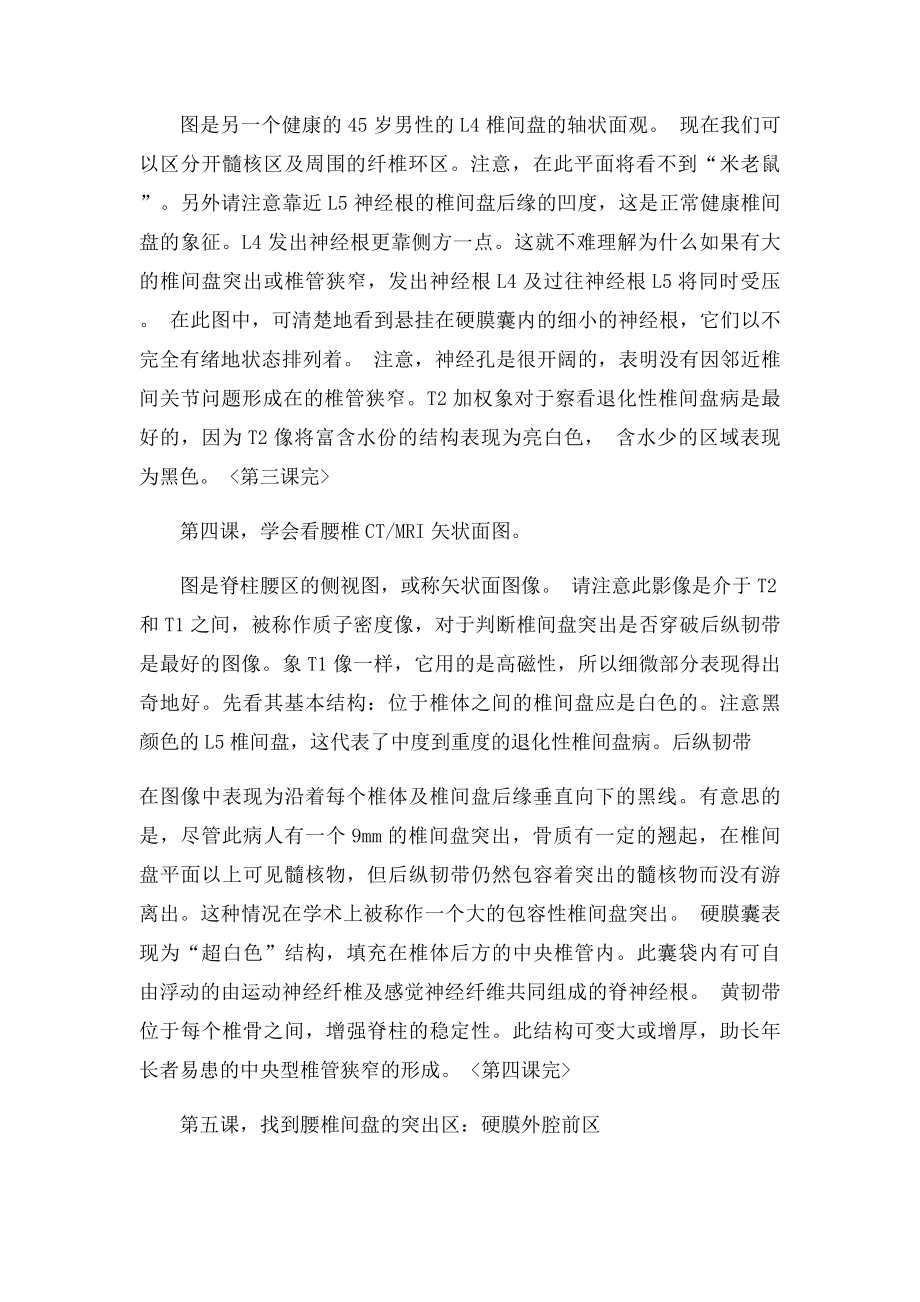 学会看腰椎间盘突出CT和MRI磁共振片子.docx_第3页