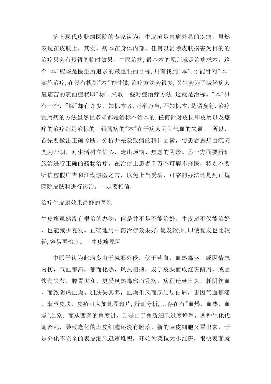 治疗牛皮癣有哪些不为人知的秘诀.docx_第2页