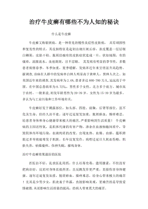 治疗牛皮癣有哪些不为人知的秘诀.docx