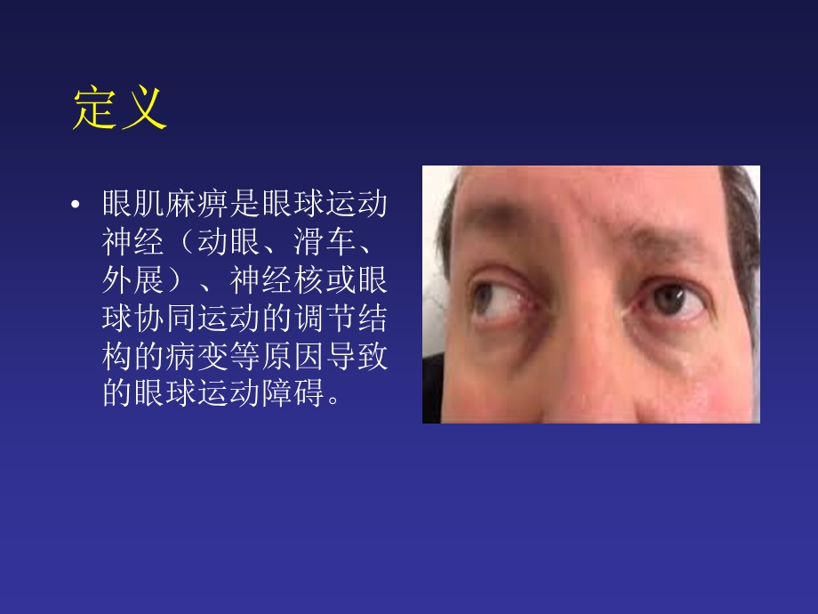 眼外肌麻痹诊断思路课件.ppt_第3页