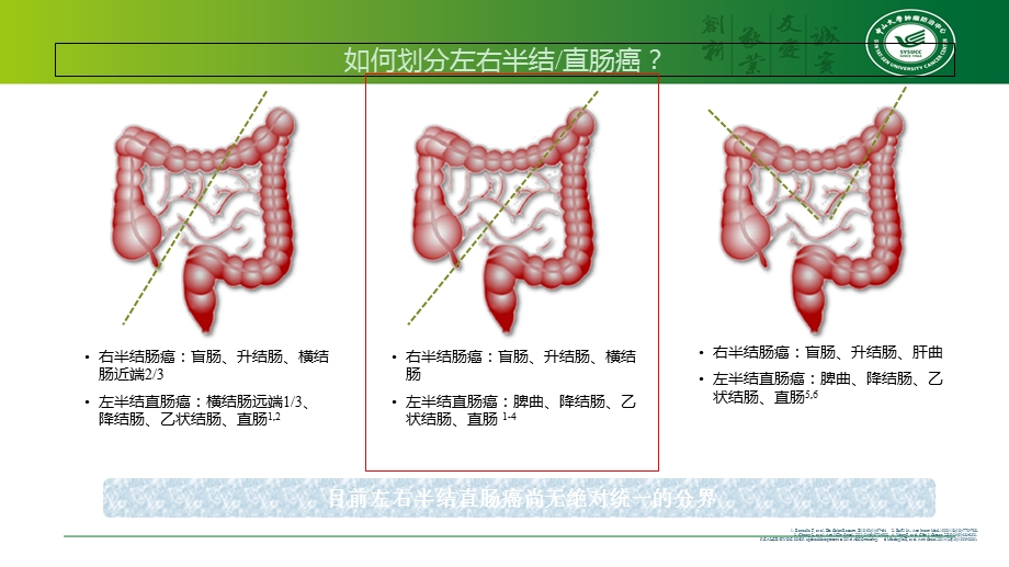 左右半结直肠癌的区别-课件.ppt_第3页