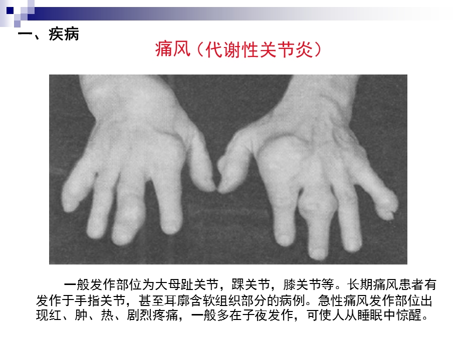 核苷酸代谢生物化学与分子生物学课件.ppt_第3页