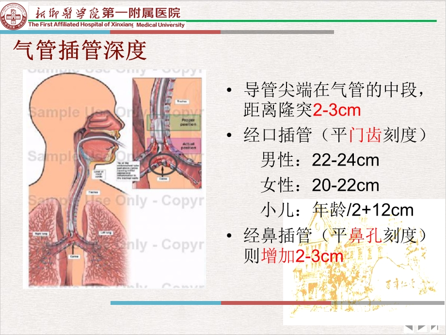 气管插管内吸痰技术完整版课件.pptx_第2页