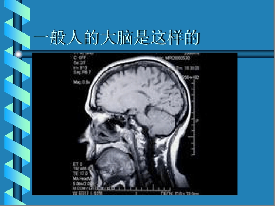 大脑的结构与功能课件.ppt_第3页