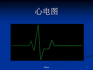 正常心电图波形特点课件.ppt