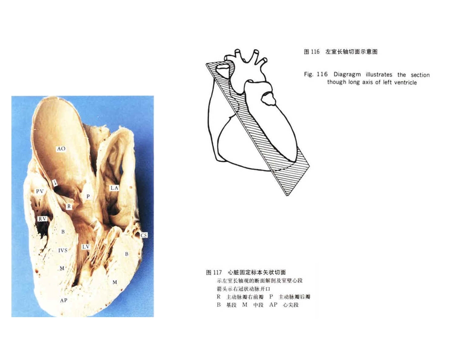 有16幅图心脏超声和心脏断面解剖及室壁心段课件.ppt_第1页