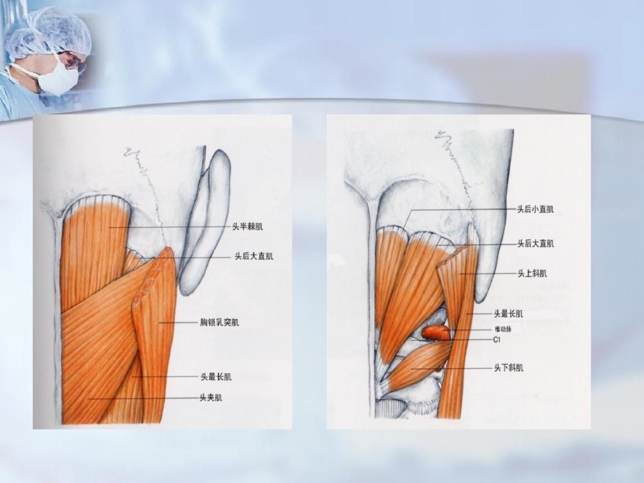 枕下乙状窦后入路局部解剖课件.ppt_第3页