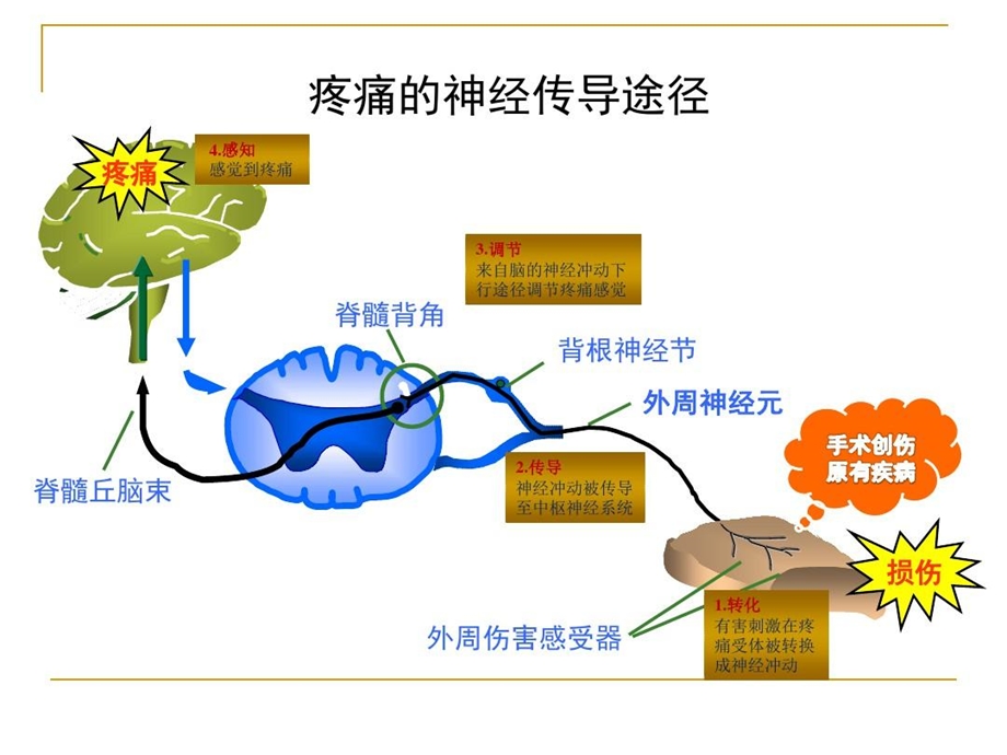 浅谈多学科协作的多模式镇痛课件.ppt_第3页