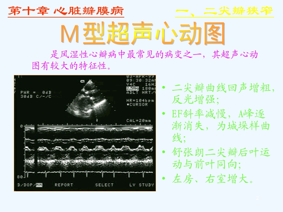 心脏彩超诊断课件.ppt_第2页