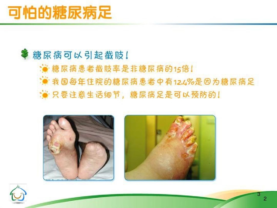 我的健康我作主糖尿病患者家庭护理课件.ppt_第3页