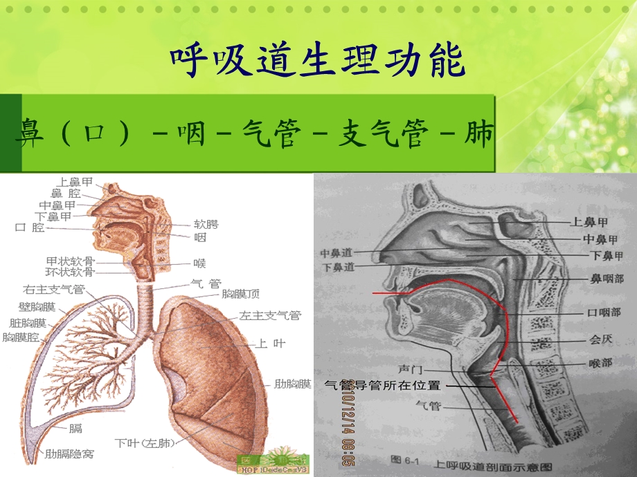 气管切开护理-课件.ppt_第3页