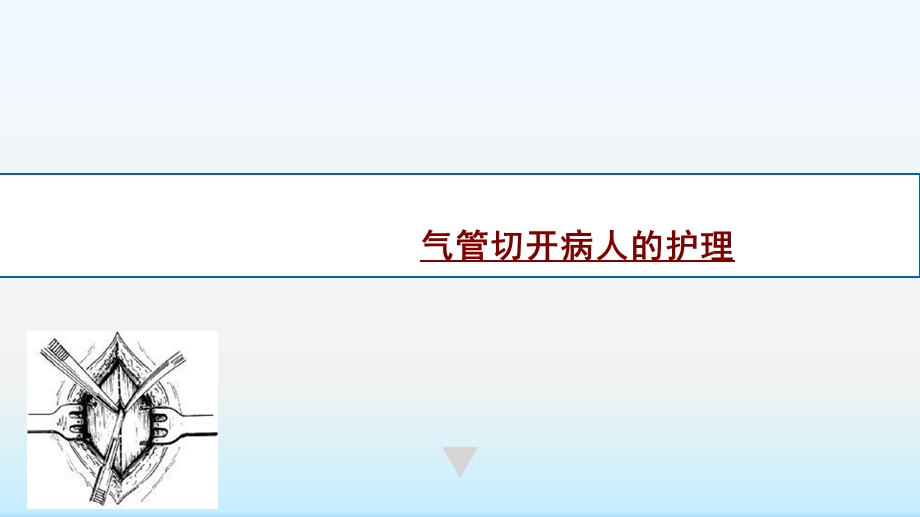 气管切开病人的护理课件.pptx_第1页
