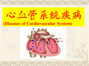 心血管1-风湿病、心瓣膜病-课件.ppt