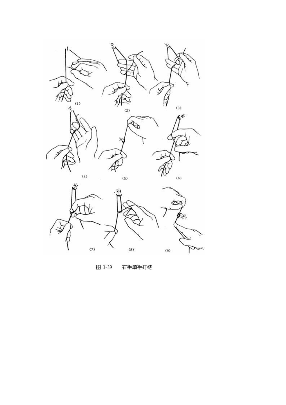 打结是外科手术操作中十分重要的的技术讲解.doc_第3页