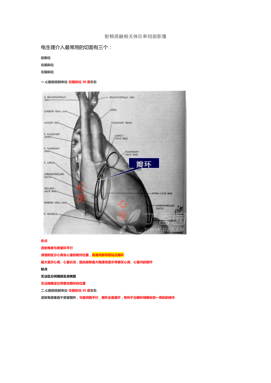 心脏电生理介入扫盲贴.docx_第1页